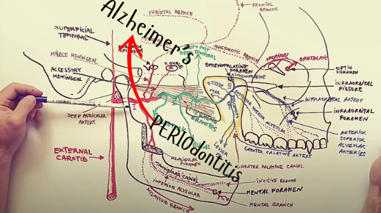 image of the relationship between periodontal disease and alzheimer's