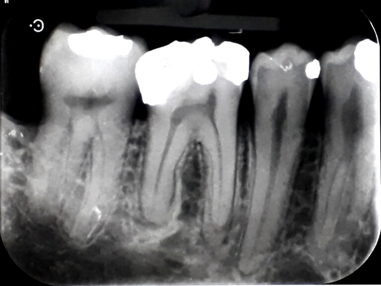 image of an oral xray