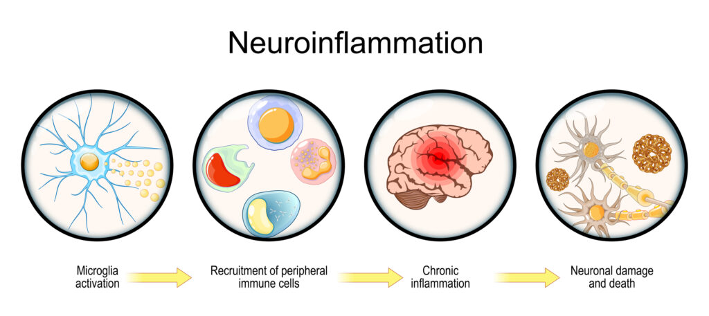 dreamstime_m_329859613 (1) diagram of the immune process in the brain